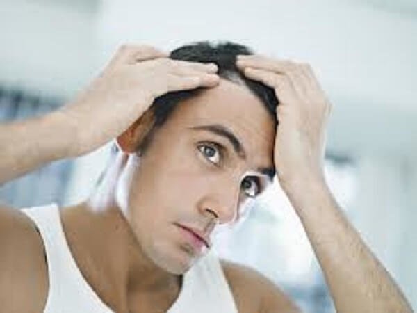 Alopecia, tratamientos naturales para la caída del cabello