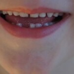 Mi primer diente - Cuento educativo