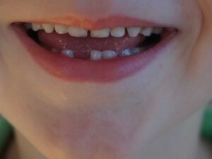 Mi primer diente - Cuento educativo
